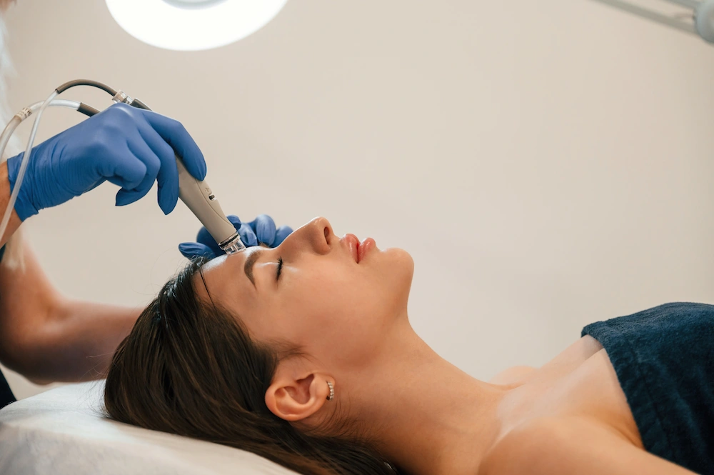 woman receiving radiofrequency microneedling on her face